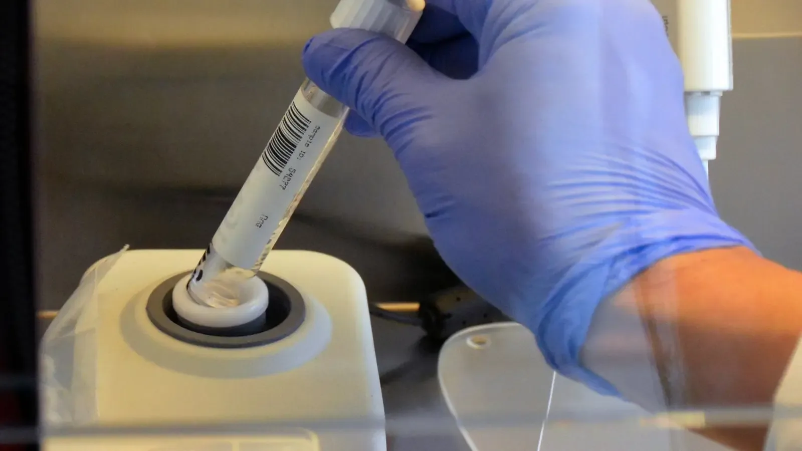 Първи грипен вирус A(H3N2) за сезона е открит у пациентка
